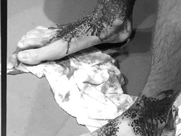 Vừa bước xuống biển, cậu bé phát hiện chân chảy máu ròng ròng, bác sĩ đang bối rối thì người cha đã tìm ra sự thật kinh hãi-1