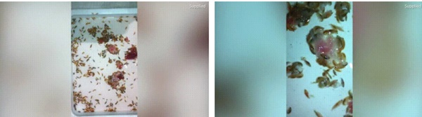 Vừa bước xuống biển, cậu bé phát hiện chân chảy máu ròng ròng, bác sĩ đang bối rối thì người cha đã tìm ra sự thật kinh hãi-4