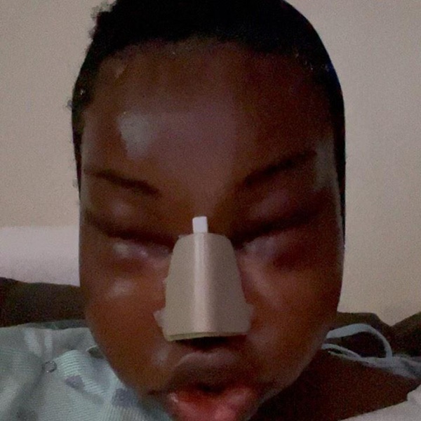 Sốc: Hoa hậu Chuyển giới Quốc tế kế nhiệm Hương Giang công khai đập mặt xây lại, nhan sắc biến dạng không nhận ra-2