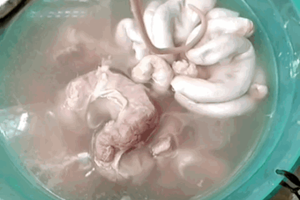 Nghe lời chị bán lòng lợn dẻo miệng 'hàng nhà chị ngon lắm', cô gái sốc nặng khi móc ra 'vật thể lạ' muốn ói liền tại chỗ!