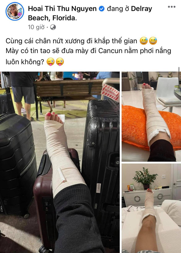 Hoa hậu Thu Hoài gặp chấn thương nghiêm trọng ở Mỹ, Hari Won - Mai Hồ cùng dàn sao Việt đồng loạt lo lắng hỏi thăm-1