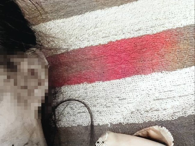 Gã chồng cầm dao đến tận chỗ làm chém vợ thương tích 42% chính thức bị khởi tố-1