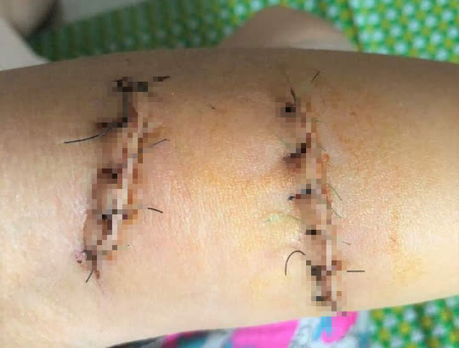 Gã chồng cầm dao đến tận chỗ làm chém vợ thương tích 42% chính thức bị khởi tố-2