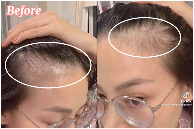 6 tháng kiên trì gội đầu bằng thứ nước này, Hoa hậu Phương Khánh nhận kết quả cực ưng với tóc con mọc tua tủa-1