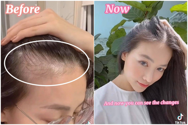 6 tháng kiên trì gội đầu bằng thứ nước này, Hoa hậu Phương Khánh nhận kết quả cực ưng với tóc con mọc tua tủa-6