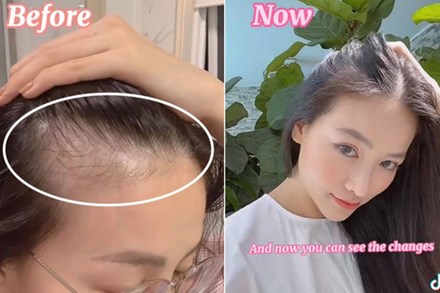 6 tháng kiên trì gội đầu bằng thứ nước này, Hoa hậu Phương Khánh nhận kết quả cực ưng với tóc con mọc tua tủa