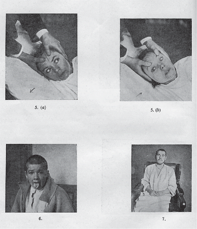 Bí ẩn bệnh công chúa ngủ trong rừng: Hội chứng khiến mọi người ngủ mê man cho đến chết, y học không thể tìm ra thuốc chữa-4