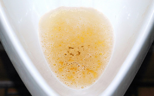 Người có thận tốt sau khi thức dậy vào buổi sáng thường có 5 đặc điểm, nếu bạn có đủ thì quá tuyệt vời-2