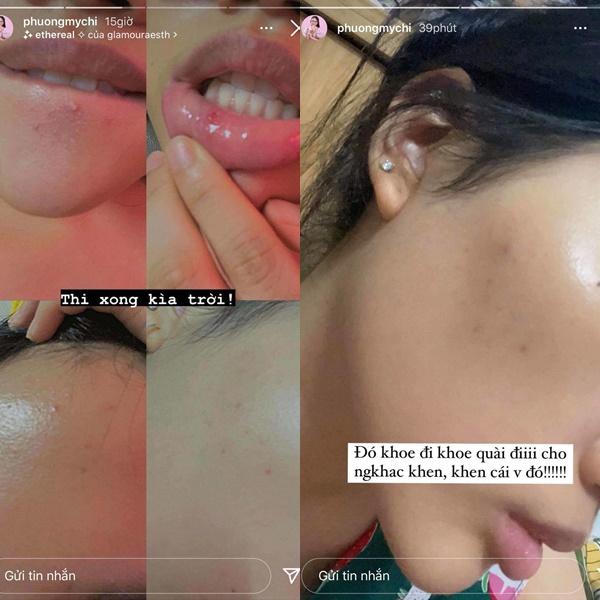 Sao Việt chăm chỉ skincare nhưng trớ trêu thay mặt vẫn đầy mụn-1