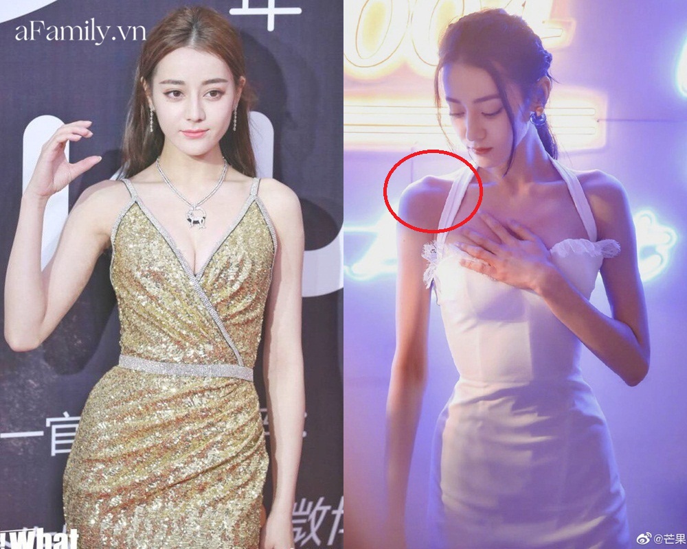 Ngược đời như Nhiệt Ba: Càng béo style càng đẹp, giảm cân quá đà lộ bao nhược điểm body chí mạng-4