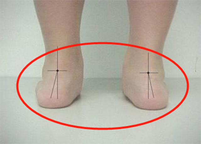 Cháu trai 4 tuổi chân bị biến dạng, bà ngoại khóc hết nước mắt vì hối hận với việc làm của mình-1