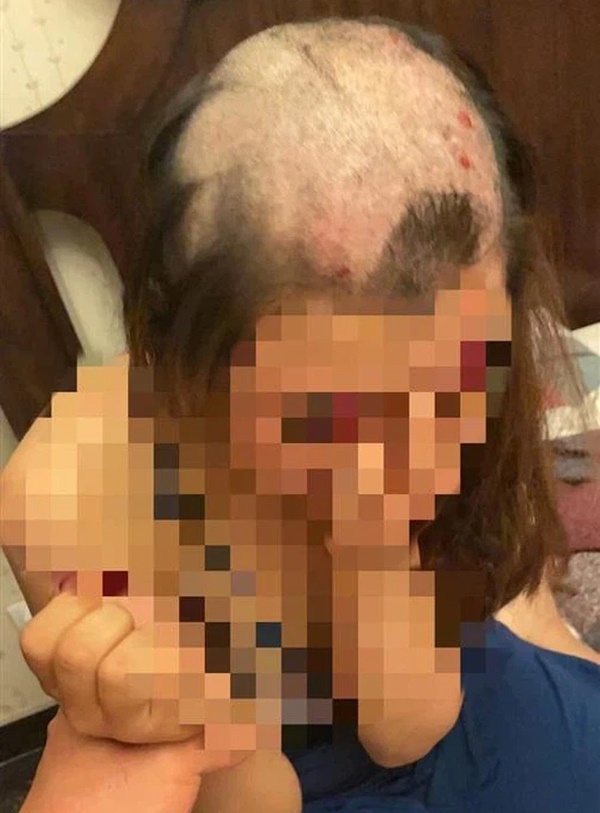 Nghi bị cắm sừng, gã chồng tức giận cạo đầu vợ nham nhở rồi tung ảnh lên mạng, nguồn cơn từ một câu tin nhắn-1