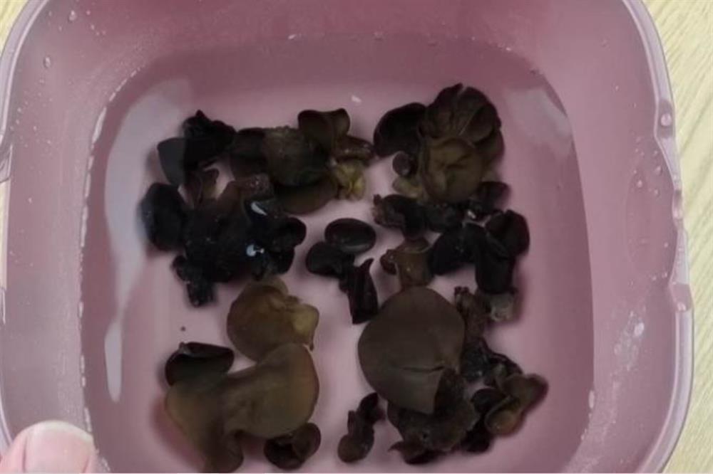 Ngâm mộc nhĩ trực tiếp vào nước tương đương với việc đưa trứng côn trùng vào người, mách bạn một mẹo, tất cả những chất bẩn sẽ biến mất hoàn toàn-6