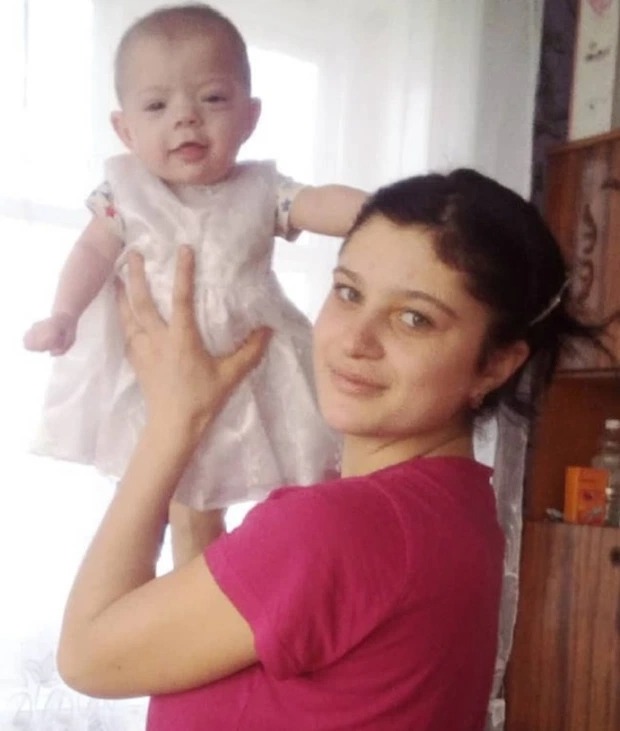 Bi thảm: Bé gái 2 tuổi bỏng nặng vì ngã vào chậu nước sôi, hành động của cha mẹ sau đó khiến đứa trẻ chết tức tưởi-1