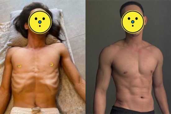 5 tháng sau khi lộ ảnh da bọc xương, body mỹ nam Vbiz này thay đổi ngoạn mục nhìn 