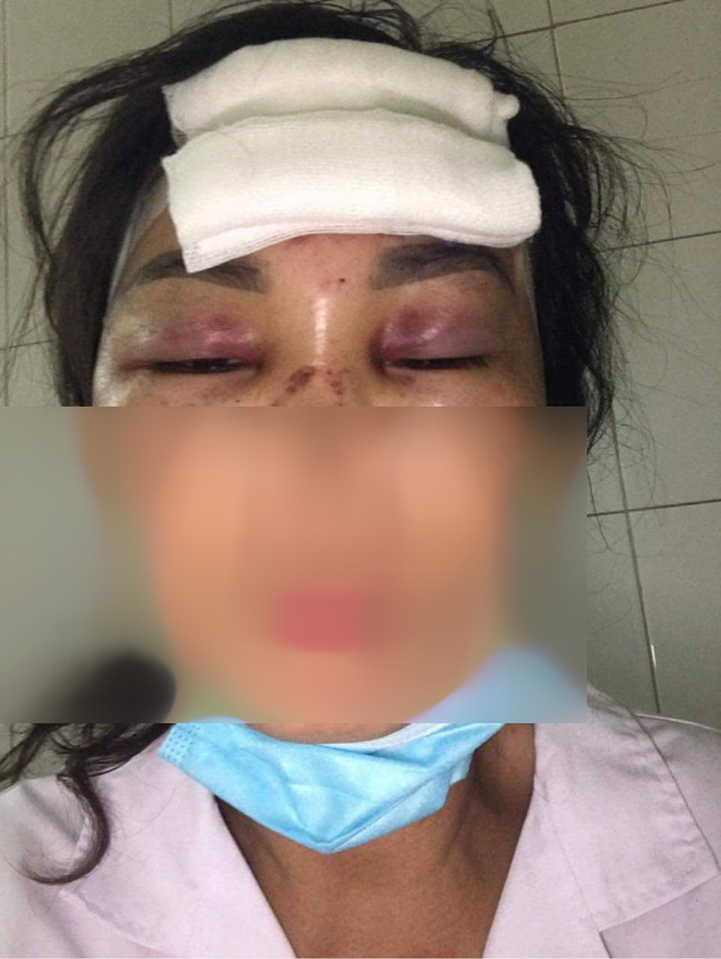 Vợ tố cáo chồng bạo hành dã man, chích điện, dìm xuống ao nước-2