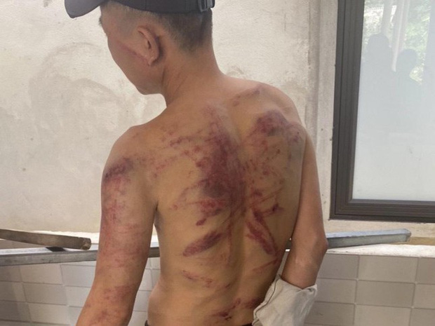 Bắt nữ quái hoạt động tín dụng đen, trút mưa roi dây điện lên người con nợ-1