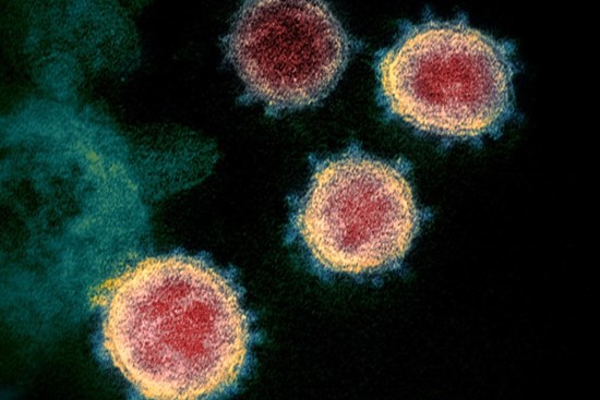 Virus SARS-CoV-2 liệu có lây qua khu thông gió chung cư?