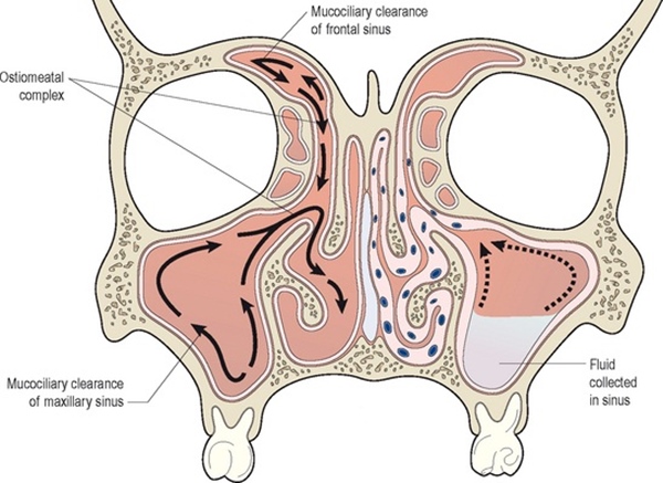 Xui nhau dùng nước muối đậm đặc súc mũi rửa virus SARS-CoV-2, bác sĩ thốt lên: Đừng nghe đồn nhảm mà... rước thêm bệnh!-1