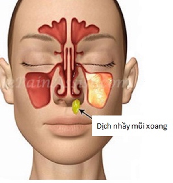 Xui nhau dùng nước muối đậm đặc súc mũi rửa virus SARS-CoV-2, bác sĩ thốt lên: Đừng nghe đồn nhảm mà... rước thêm bệnh!-3