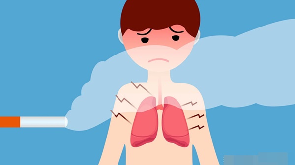 Ngoài hút thuốc lá thì 4 thói quen này sản sinh ra tế bào ung thư phổi: Điều cuối cùng ai cũng làm mỗi ngày mà không biết-1