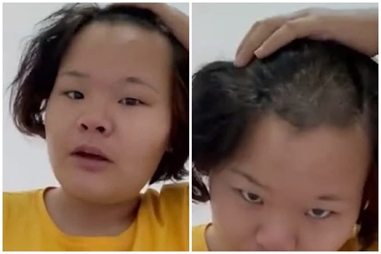 Mẹ ngủ dậy choáng váng phát hiện bị con cạo mất nửa đầu, nguyên nhân đằng sau khiến cô mếu máo cười ra nước mắt