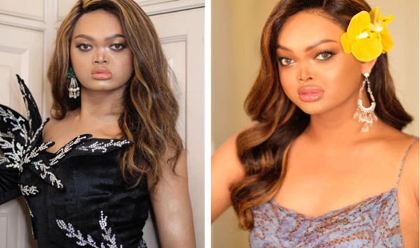 Từng bị chế giễu là Happy Polla phiên bản gầy”, cô gái Thái Lan khiến ai nấy ngỡ ngàng với diện mạo và cuộc sống hiện tại-8