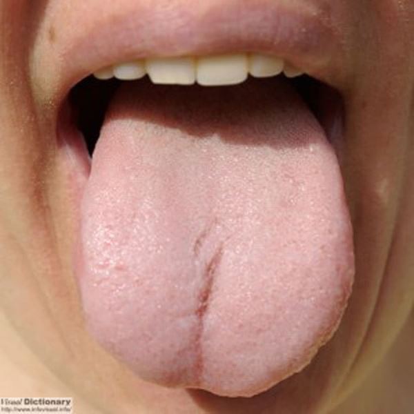 7 bất thường ở lưỡi đang cảnh báo bệnh tật nhưng lại bị hầu hết mọi người bỏ qua-3