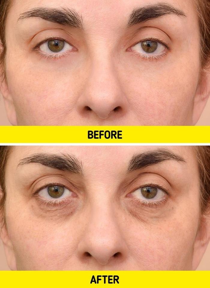 Nghe lạ mà thật: Rửa mặt dưới vòi hoa sen dễ hình thành nếp nhăn xấu xí-3