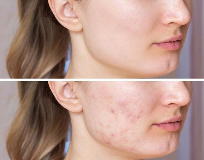 Nghe lạ mà thật: Rửa mặt dưới vòi hoa sen dễ hình thành nếp nhăn xấu xí-4