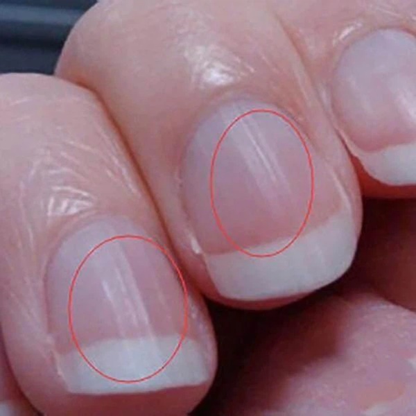 5 dấu hiệu trên móng tay cho thấy cơ thể bạn đang thiếu chất dinh dưỡng-1
