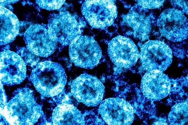 Phát hiện quan trọng về virus SARS-CoV-2 giúp phát triển thuốc chữa Covid-19-1