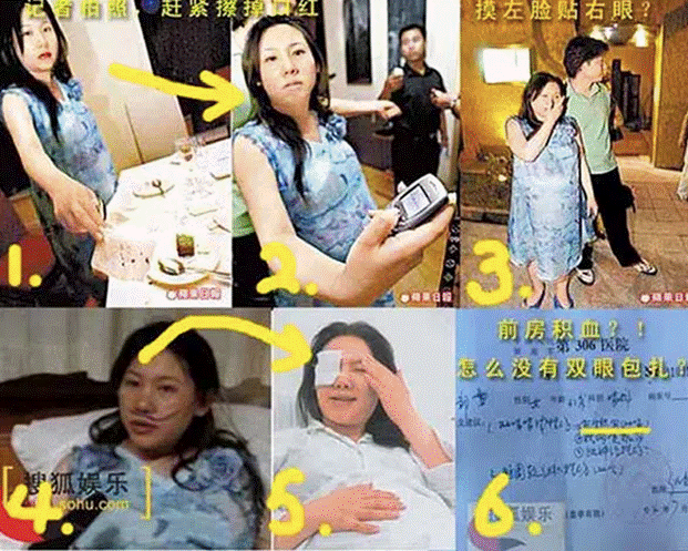 Triệu Vy: Én nhỏ hóa diều hâu thủ đoạn với 1001 bê bối hung đồ, ăn cháo đá bát cho đến làm tiểu tam và quả báo đến muộn-13