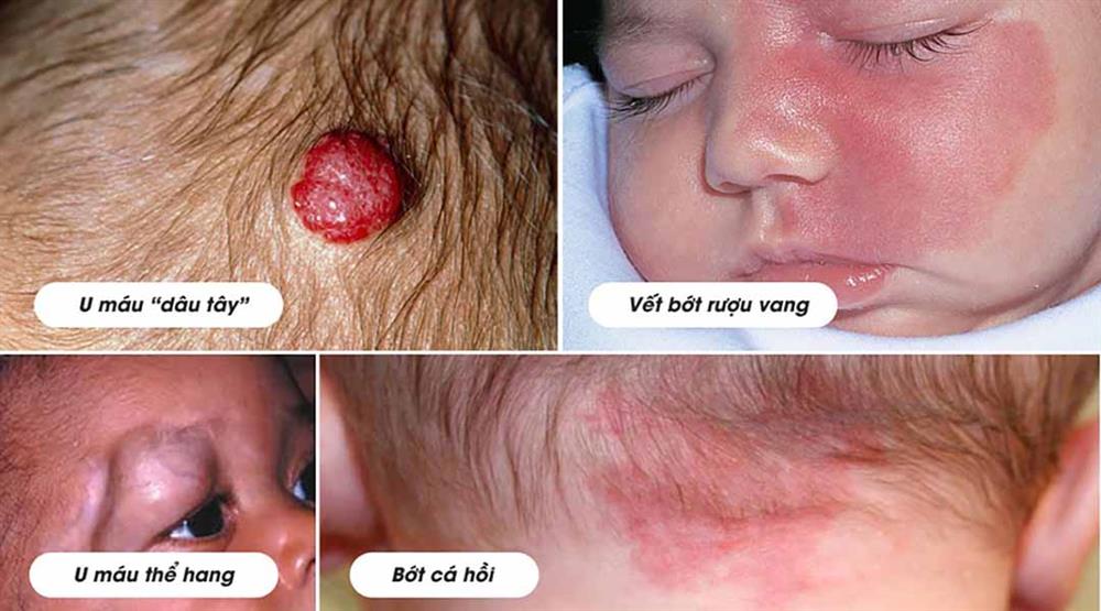 Khi mang thai mà mẹ bầu làm 3 việc này, con sinh ra rất dễ bị thua thiệt về nhan sắc-2