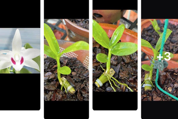 Ông bố trẻ đột ngột phải cắt bỏ nửa bộ não, lý do bắt nguồn từ một sai lầm đơn giản nhiều người mắc phải-7