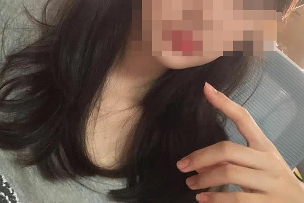 4 dấu hiệu trên bàn tay cảnh báo đường huyết cao nhưng thường bị người trẻ bỏ qua, không muốn bị tiểu đường thì nên kiểm tra ngay-2