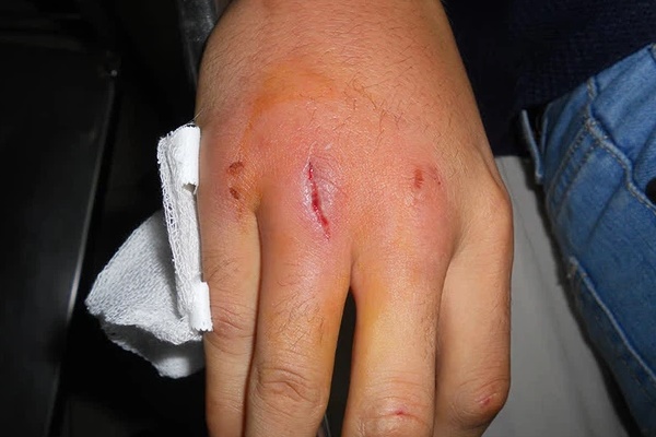 Ai cũng nghĩ tiểu đường là do ăn ngọt mà không biết 4 món ngon sau đây còn khiến đường huyết tăng cao đột biến hơn-6