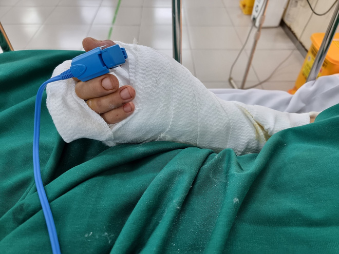 Sức khỏe hiện tại của người đàn ông bị nam tài xế chém đứt lìa tay khi đang chở F0 đi điều trị-3
