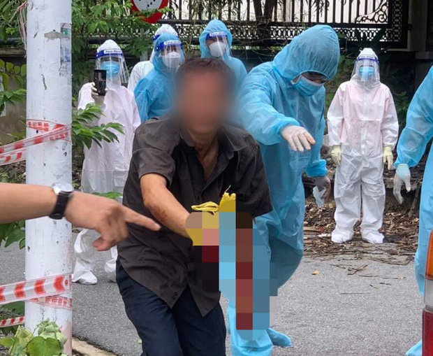 Sức khỏe hiện tại của người đàn ông bị nam tài xế chém đứt lìa tay khi đang chở F0 đi điều trị-4