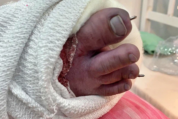 Em bé bất ngờ tụt khỏi xe máy khi đang ngồi cùng bố mẹ, chạy băng qua đường và khoảnh khắc kinh hoàng ngay sau đó-3