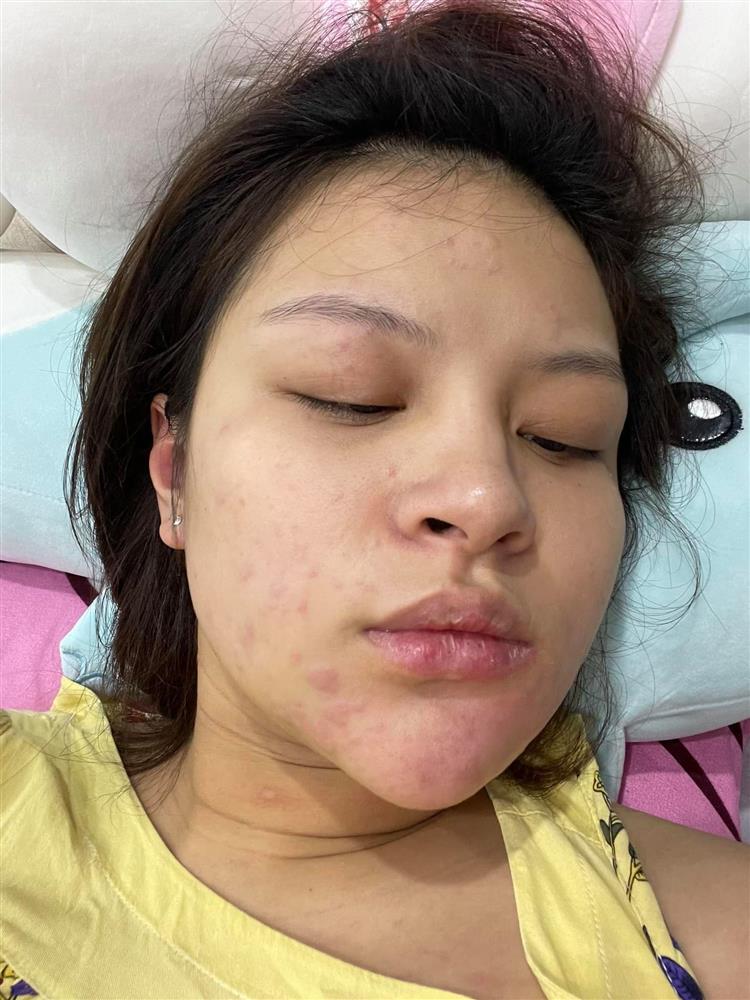 Nữ diễn viên Hướng dương ngược nắng chia sẻ bộ ảnh bầu bí xấu xí kinh hoàng, phá nét đến khó tin-2