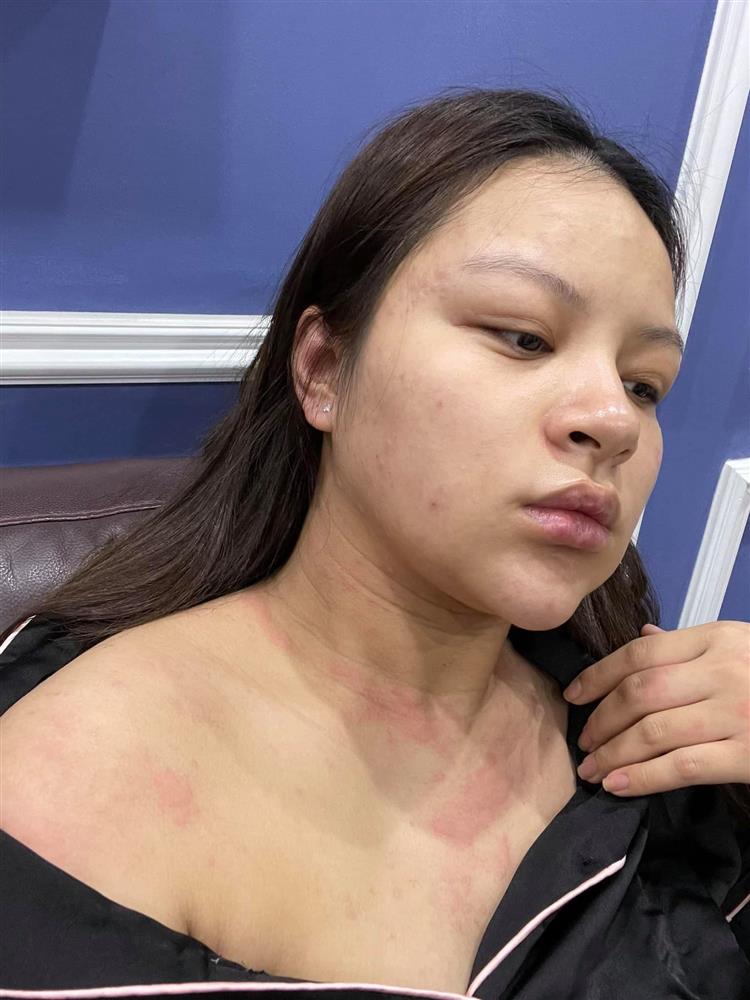 Nữ diễn viên Hướng dương ngược nắng chia sẻ bộ ảnh bầu bí xấu xí kinh hoàng, phá nét đến khó tin-4