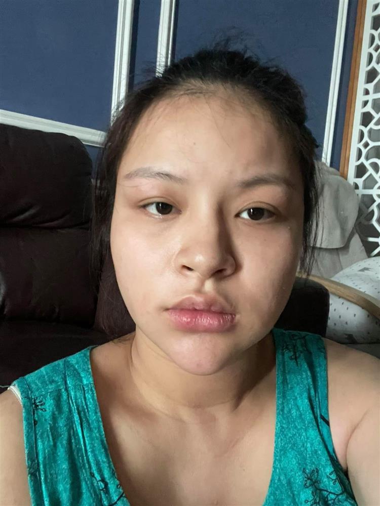 Nữ diễn viên Hướng dương ngược nắng chia sẻ bộ ảnh bầu bí xấu xí kinh hoàng, phá nét đến khó tin-5