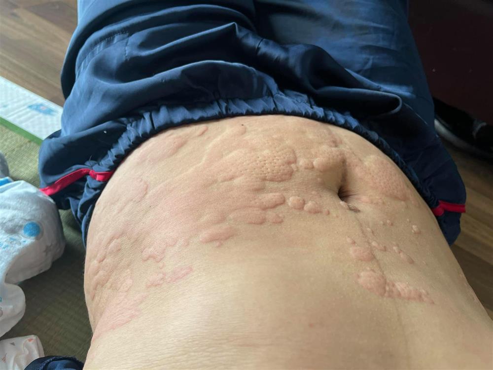 Nữ diễn viên Hướng dương ngược nắng chia sẻ bộ ảnh bầu bí xấu xí kinh hoàng, phá nét đến khó tin-6