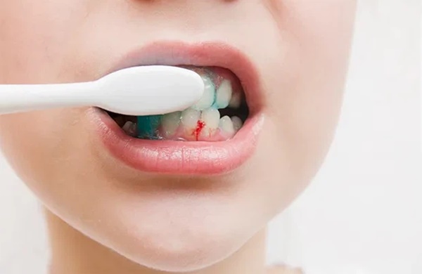 5 dấu hiệu ở miệng cho thấy gan đang bị tổn thương, nếu có dù chỉ 1 cái bạn cũng nên đi khám ngay-1