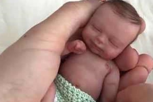 Mẹ ép con gái nhảy dây 3000 cái mỗi ngày, mắng mỏ khi con than đau chân, nghe chẩn đoán của bác sĩ mà xót xa hối hận-4