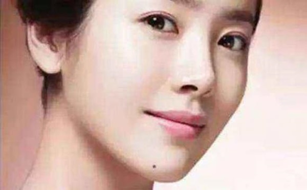 4 nốt ruồi tài lộc, ai có được dù là nam hay nữ đều hưởng phúc khí ông trời phù hộ, làm gì cũng hanh thông-2