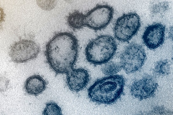 Phát hiện mới về những người có siêu kháng thể với Covid-19-1