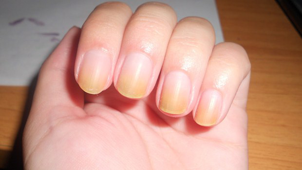 Người có gan kém thường sẽ đạt được 4 chứng bệnh không bình thường ở bàn tay, nếu không có thì gan vẫn rất mạnh bạo-3