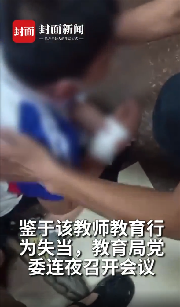Học sinh tiểu học viết chữ xấu bị cô giáo rạch tay gây chấn động dư luận Trung Quốc-2